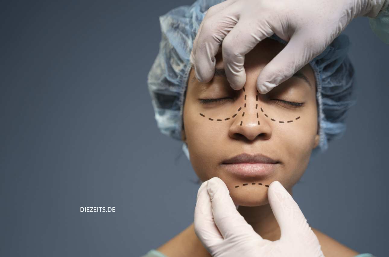 Rhinoplasty in Dubai
