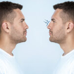 The Incredible Evolution of Nose Enhancements: Then vs. Now