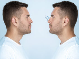 The Incredible Evolution of Nose Enhancements: Then vs. Now