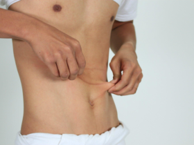 Effective Cosmetic Ways to Combat Loose Stomach Skin